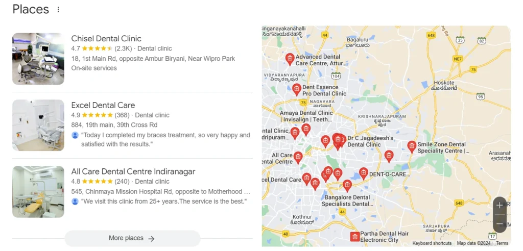 dental clinic in banglore