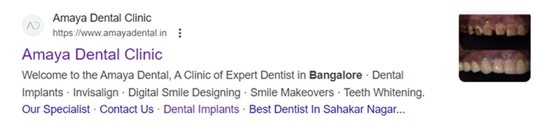 Amaya Dental Clinic in Bangalore exterior view and dental care services